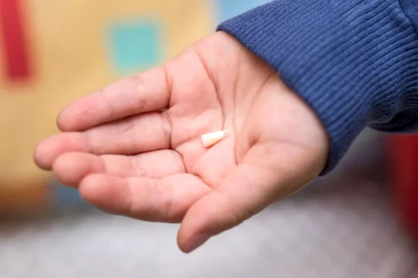 ฝันว่าฟันหลุด