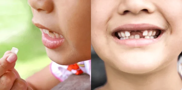 ฝันว่าฟันล่างหลุด