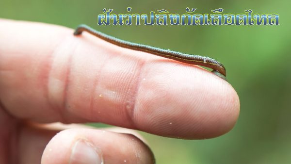 ฝันว่าปลิงกัดเลือดไหล