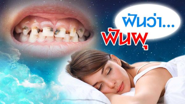 ฝันว่าฟันผุหลายซี่