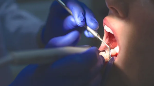 ทำนายฝัน ไปทำฟันเลขเด็ด-"Dreaming about going to get dentistry, lucky numbers."