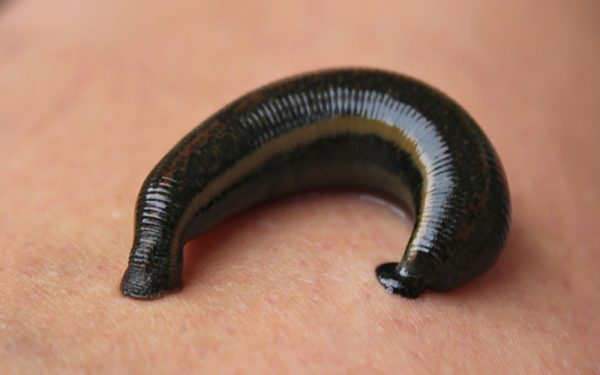 ฝันเห็นปลิงดูดเลือด เลขเด็ด-"Seeing bloodsucking leeches in dream"