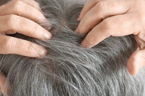 ทำนายฝัน ถอนผมหงอกพันทิป -"Dream about plucking gray hair pantip"