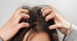 ฝันเห็นเหาบนหัว-"Dream of seeing lice on your head"